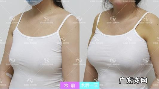 丰胸图片