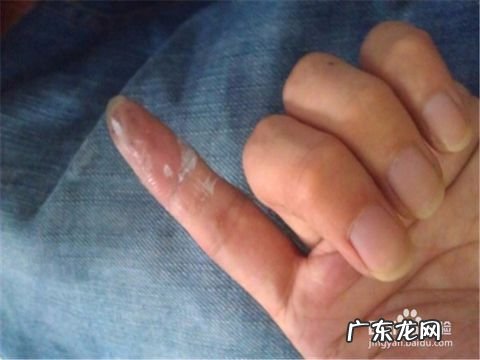 手上粘胶水了怎么去掉