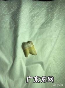 4颗智齿全拔了好不好