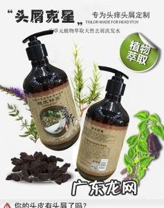 去屑止痒最好的洗发水