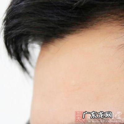 修行人额头出现形状