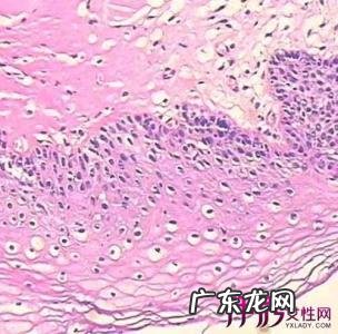 假性尖锐疣与真的照片